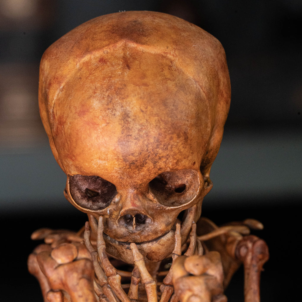 Baby human fetus skeleton on vintage gothic frame.
anatomical accurate model 
human skull
human skeleton
oddities and curiosities 
gothic wall decor
dark academia
WitchCraft collectibles
horror home decor
afterlife art
Creepy tabletop decor